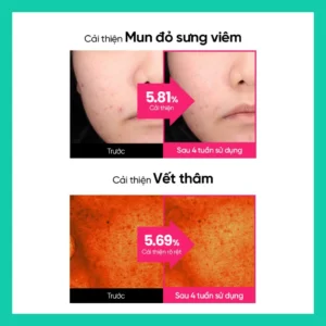 Toner Pad BEPLAIN Cicaterol Blemish Pad 180ml 70 miếng – làm dịu và chăm sóc da mụn